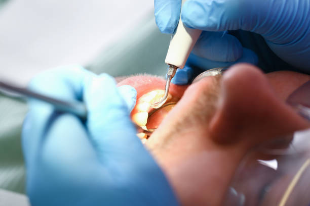 Best Emergency Tooth Extraction in White Island Shores, MA